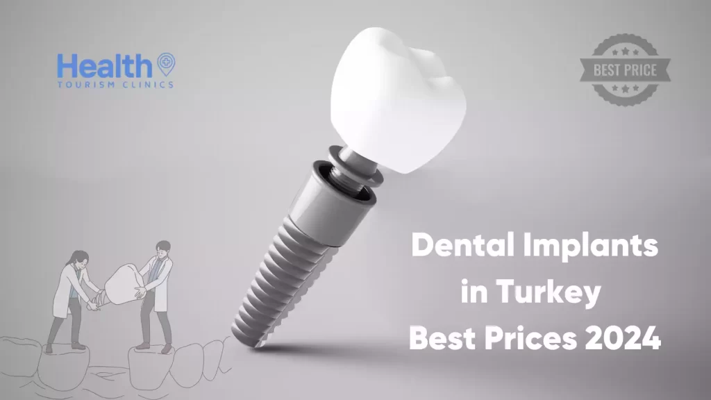 Dental İmplants in Turkey Best Price