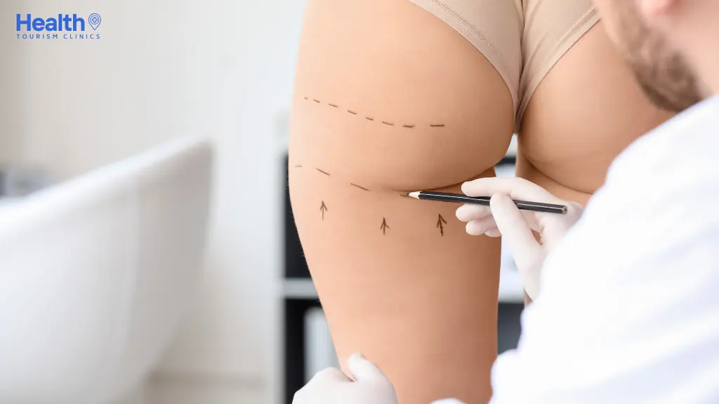 Best Clinics in Turkey for Liposuction