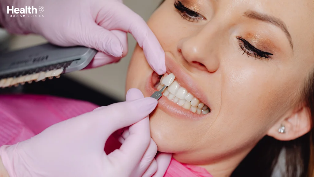 Dental Veneers Treatment