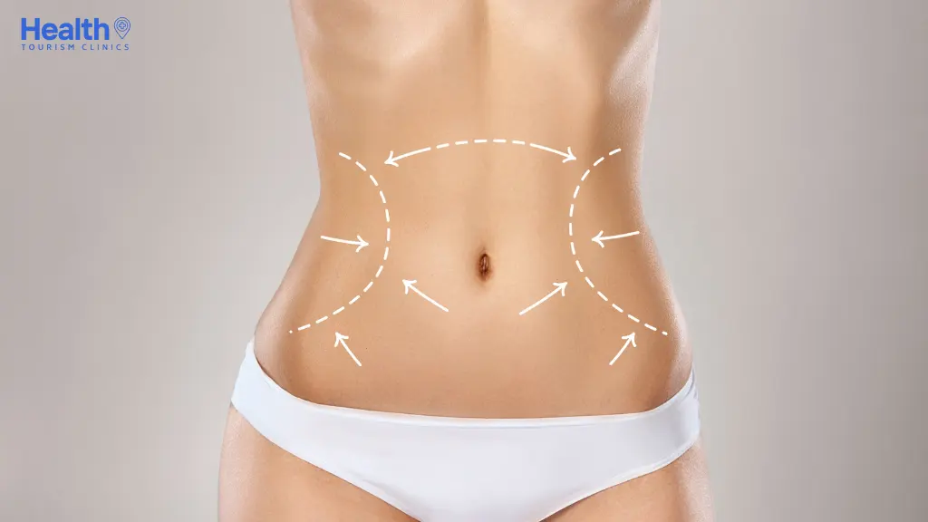 How Much is Liposuction in Turkey? (Best Clinics 2024)