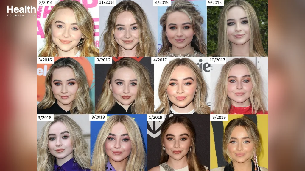 Sabrina Carpenter Plastic Surgery Before After Photos