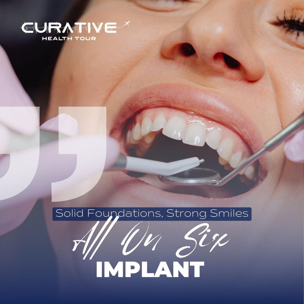 Curative Health Tour All on Six Implant